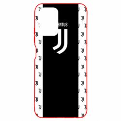 Чехол для Xiaomi Redmi Note 10 Juventus pattern - PrintSalon