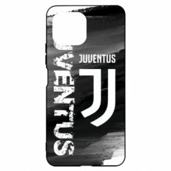 Чохол для Xiaomi Mi11 Lite Juventus - PrintSalon
