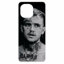 Чехол для Xiaomi Mi11 Lil Peep fuck the population - PrintSalon
