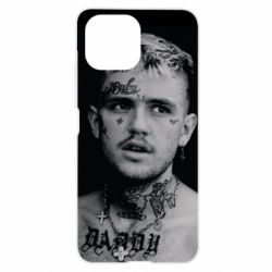 Чехол для Xiaomi Mi11 Lite Lil Peep fuck the population - PrintSalon