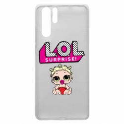Чехол для Huawei P30 Pro LoL surprise baby - PrintSalon