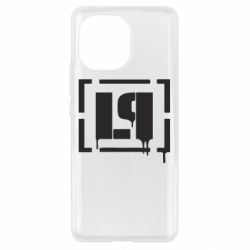 Чехол для Xiaomi Mi11 LP - PrintSalon