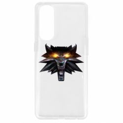 Чехол для Oppo Reno 4 Pro Metallic symbol - PrintSalon