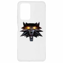 Чехол для Xiaomi Redmi Note 10 Pro Metallic symbol - PrintSalon