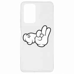 Чехол для Xiaomi Redmi Note 10 Pro Mickey Mouse Hands "Chop-chop" - PrintSalon