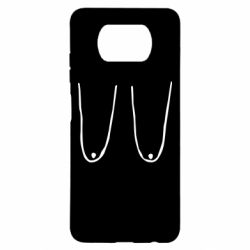 Чохол для Xiaomi Poco X3 Обвислі груди - PrintSalon