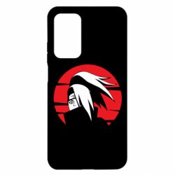 Чохол для Xiaomi Mi 10T / 10T Pro Deidara Naruto - PrintSalon