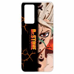 Чехол для Xiaomi Mi 10T/10T Pro Доктор Стоун Арт - PrintSalon