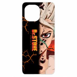 Чехол для Xiaomi Mi11 Доктор Стоун Арт - PrintSalon