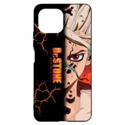 Чехол для Xiaomi Mi11 Lite Доктор Стоун Арт - PrintSalon