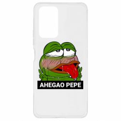 Чехол для Xiaomi Redmi Note 10 Pro Аhegao PePe - PrintSalon