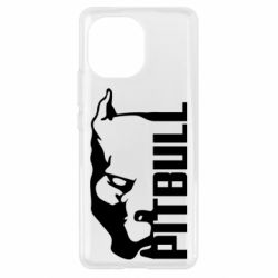 Чехол для Xiaomi Mi11 Pitbull - PrintSalon