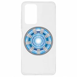 Чехол для Xiaomi Redmi Note 10 Pro Реактор Тони Старка - PrintSalon