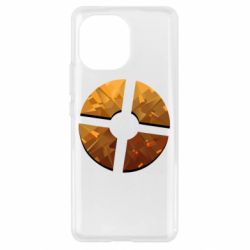 Чехол для Xiaomi Mi11 TF 2 - PrintSalon
