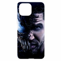 Чехол для Xiaomi Mi11 Lite Venom face Tom Hardy - PrintSalon