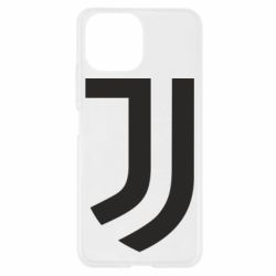 Чехол для Xiaomi Mi11 Lite Ювентус - PrintSalon