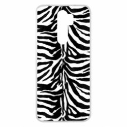 Чехол для Xiaomi Redmi Note 8 Pro Zebra skin - PrintSalon