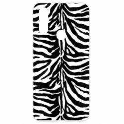 Чехол для Oppo A31 Zebra skin - PrintSalon