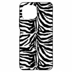 Чехол для Xiaomi Mi11 Lite Zebra skin - PrintSalon