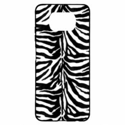 Чехол для Xiaomi Poco X3 Zebra skin - PrintSalon